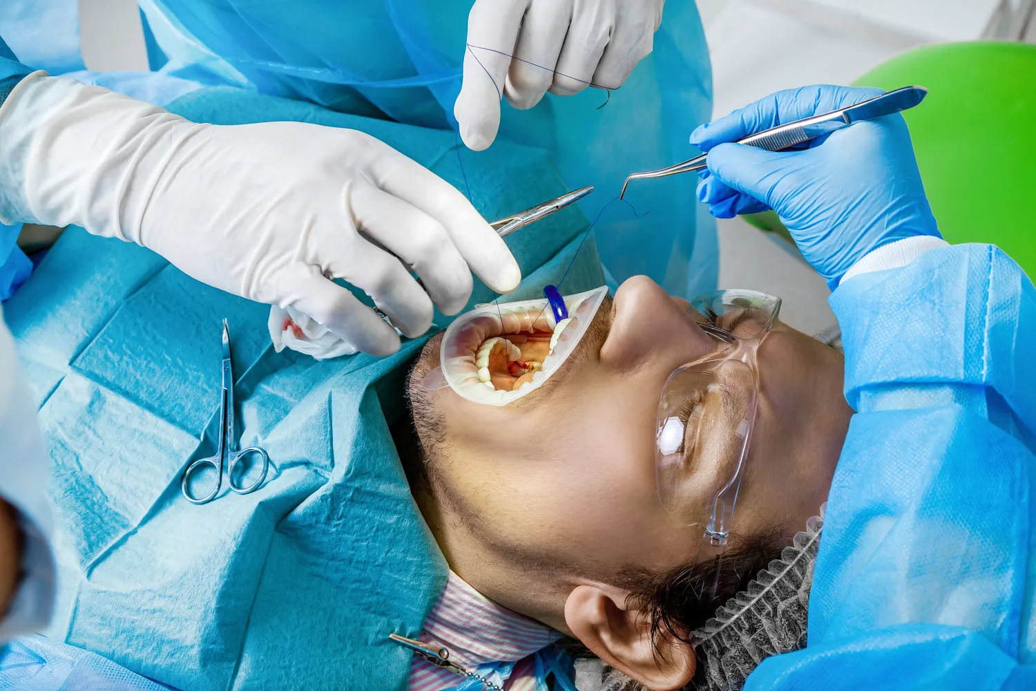 E recepta jak dziala?